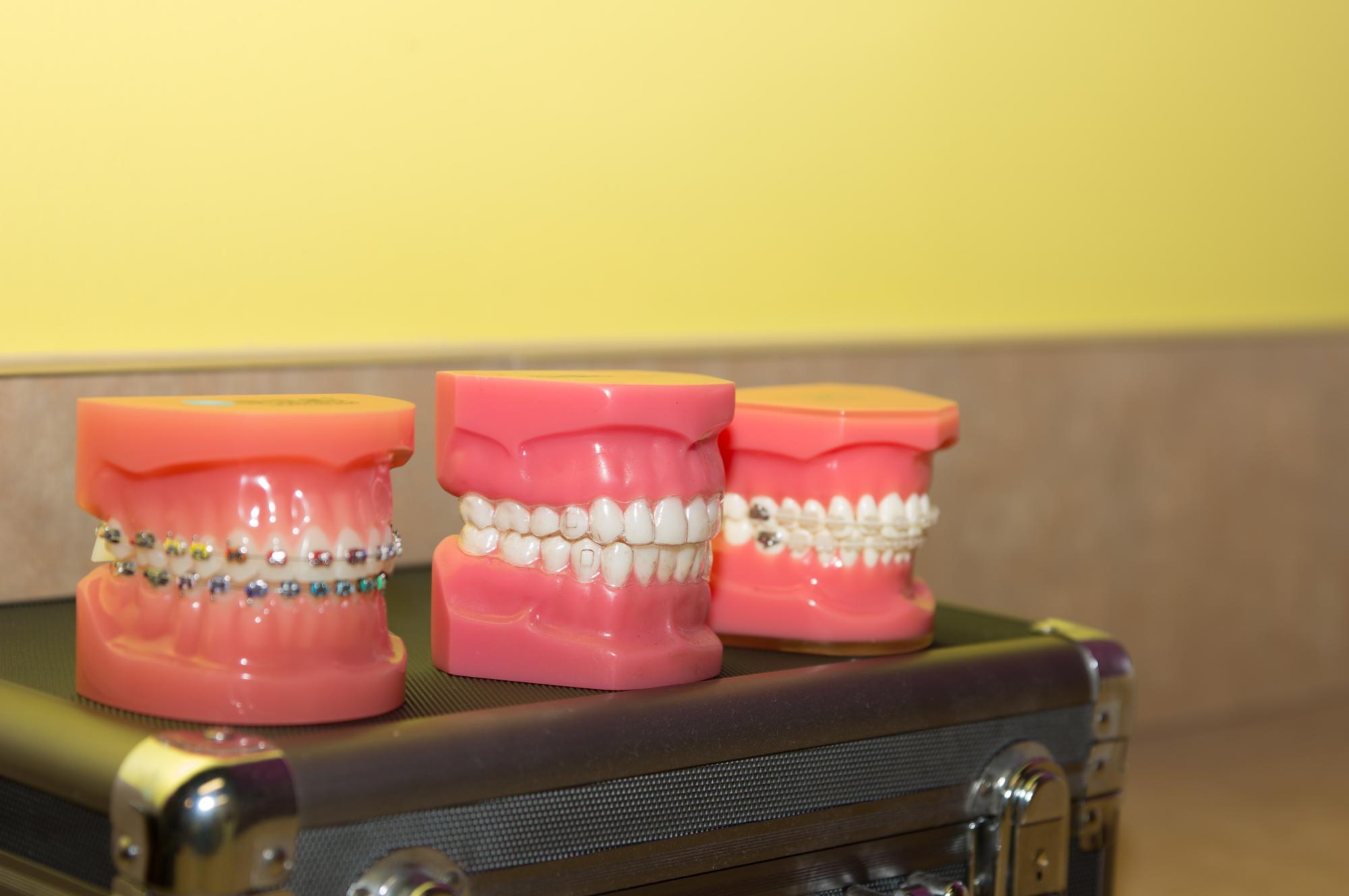 brentwood orthodontics